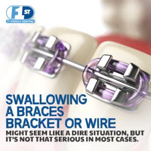 swallowed metal bracket braces|can you swallow a retainer.